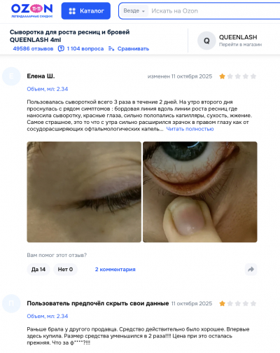 Queenlash отзывы: что скрывается за обещаниями длинных ресниц